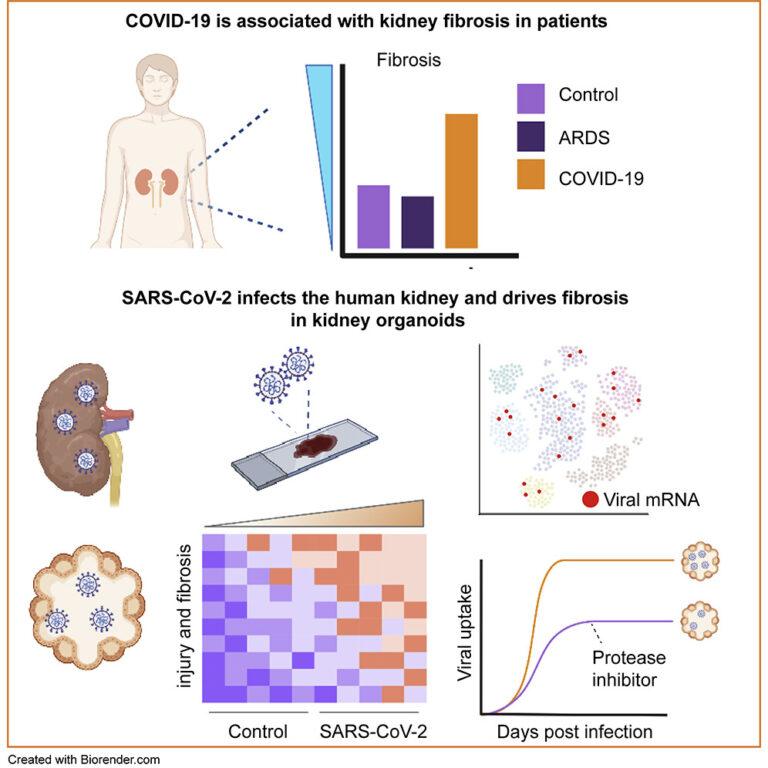 Cell Stem Cell publication: SARS-CoV-2 infects the human kidney and drives fibrosis in kidney organoids